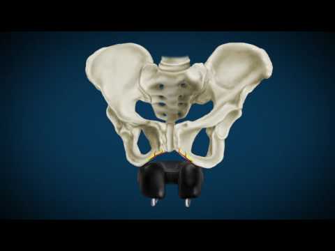 Showing detailed video of ISM saddle PS1.1 black